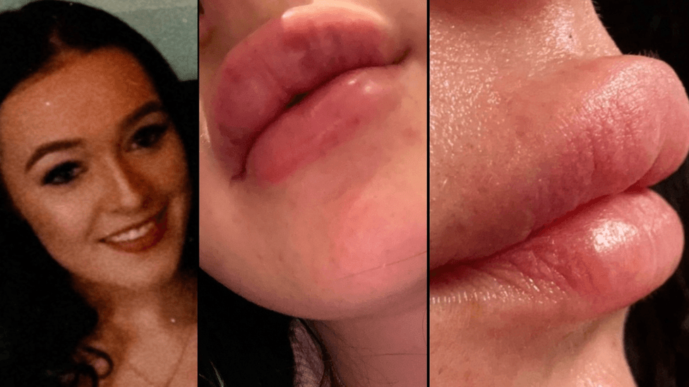 lips.png
